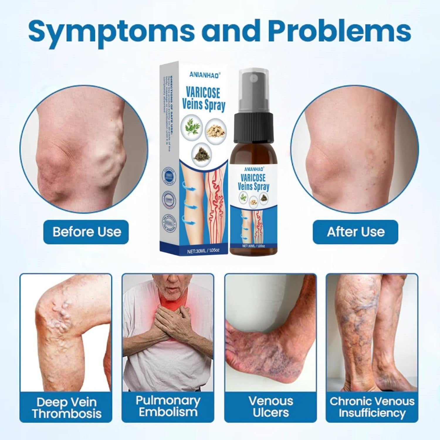 3 packs VeinGuard Herbal Spray: Varicose Vein Treatment for Legs & Circulation